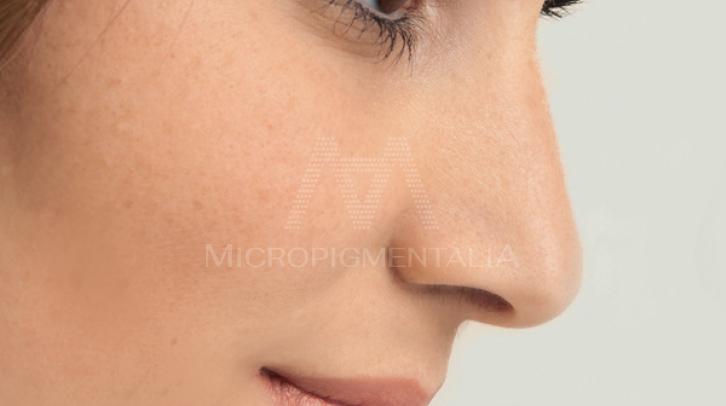 Después · Antiaging