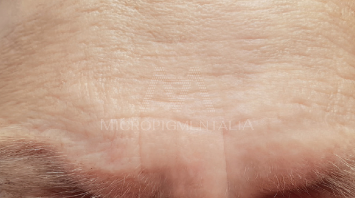 Tratamiento antiaging de micropigmentación