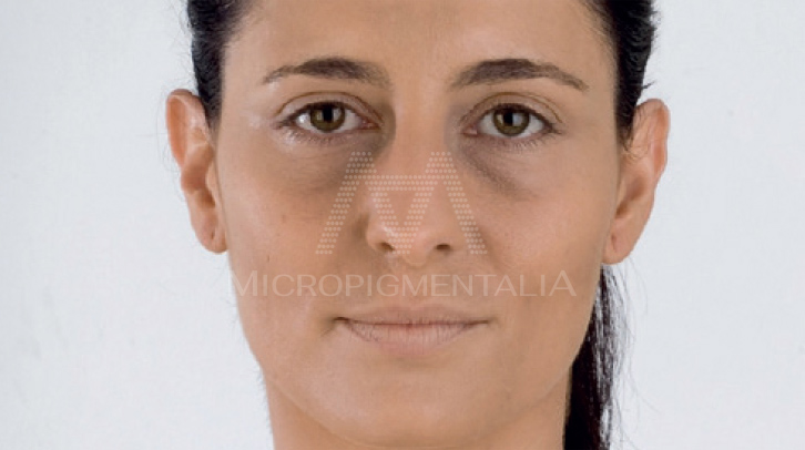 Antes · Dermatológico